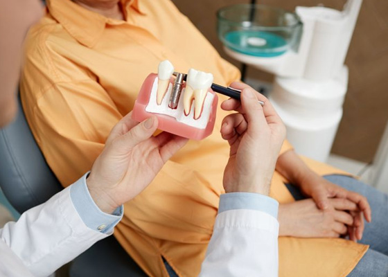 Dentist using model to discuss dental implants