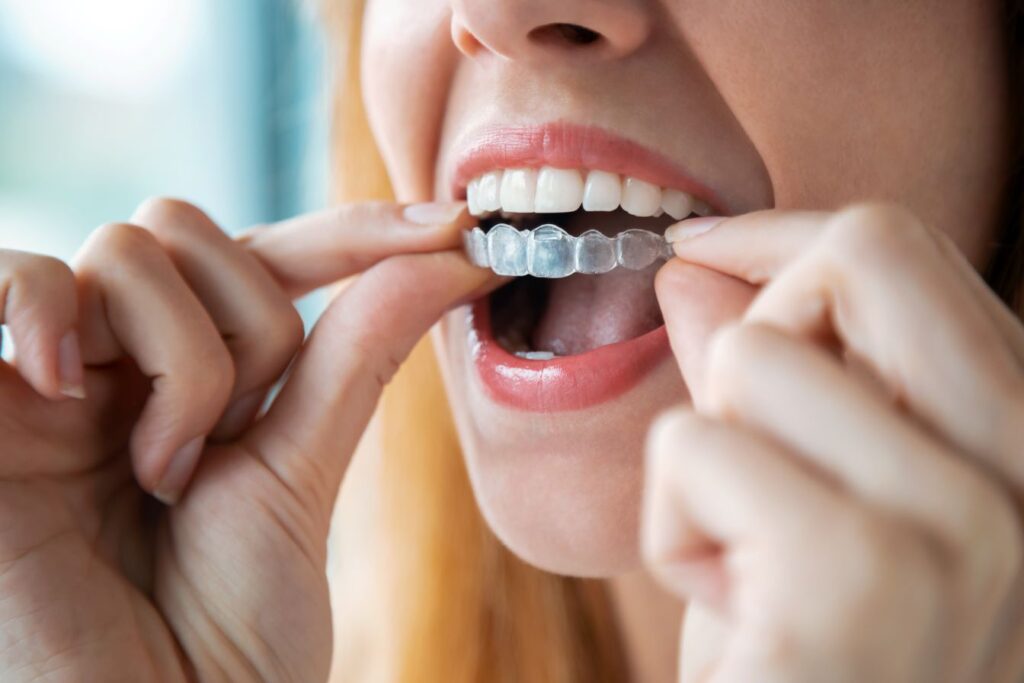 A woman putting a clear aligner on her teeth.